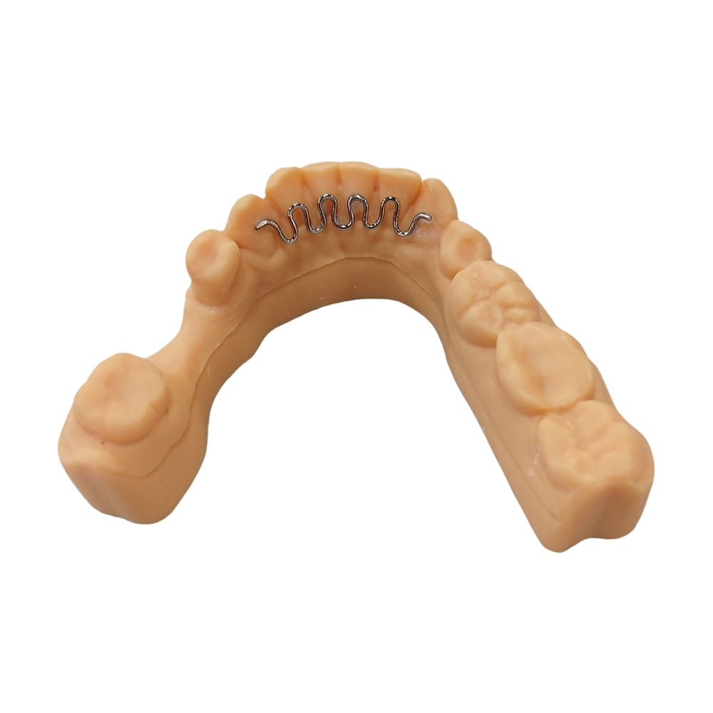 Contention dentaire | MM Dental – Laboratoire Dentaire