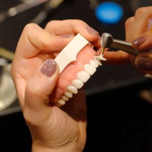 Webinaire — Facettes esthétiques en composite par injection directe Webinaire — Facettes esthétiques en composite par injection directe